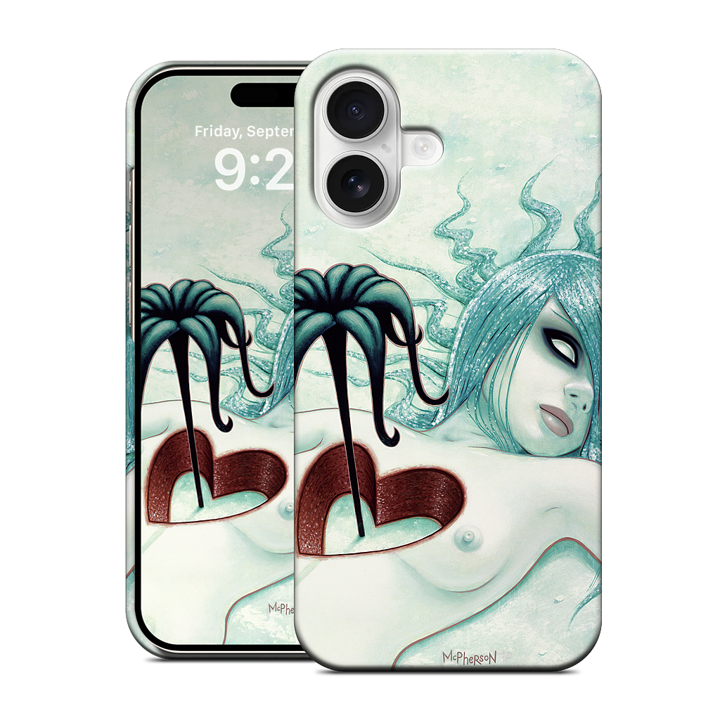 Hey We All Die Sometimes iPhone Case